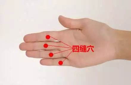 艾灸后宝宝不吃饭都不行,因为真的饿......