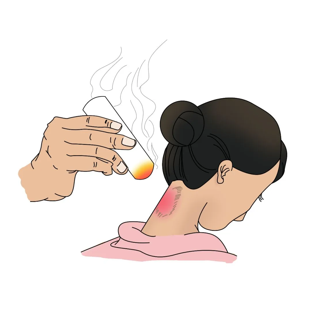 富贵包的克星,艾灸这几个穴,赶紧灸吧!