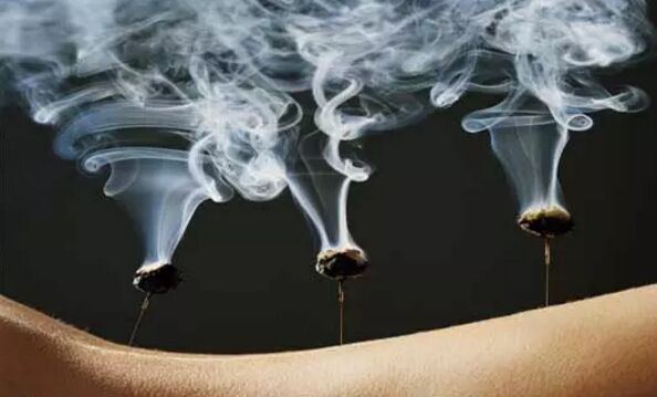 温针灸的功效膝关节炎针灸治疗视频