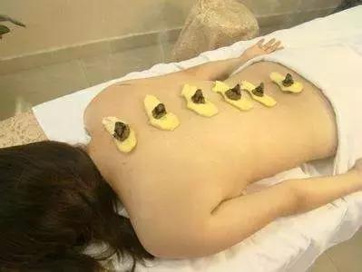 隔姜灸是什么?隔姜艾灸的作用与功效