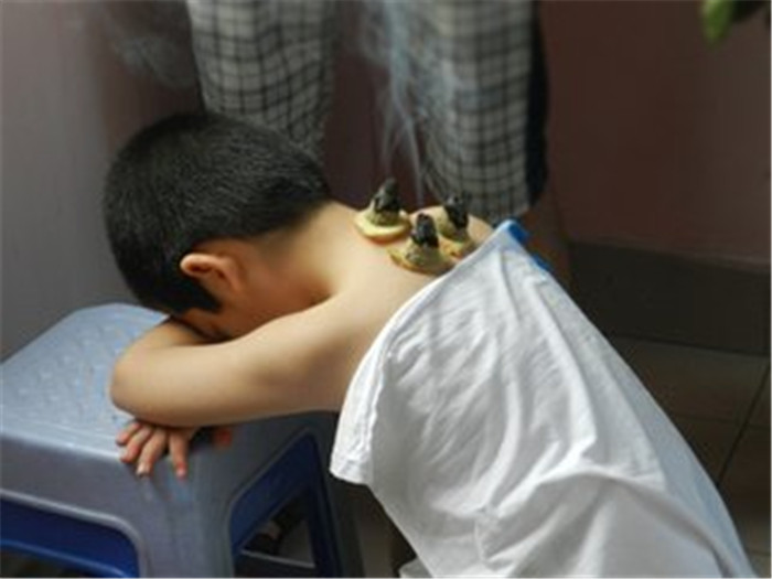 艾炷灸可分为直接灸和间接灸