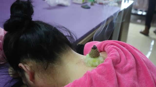 30个艾灸常见小知识，艾灸的作用