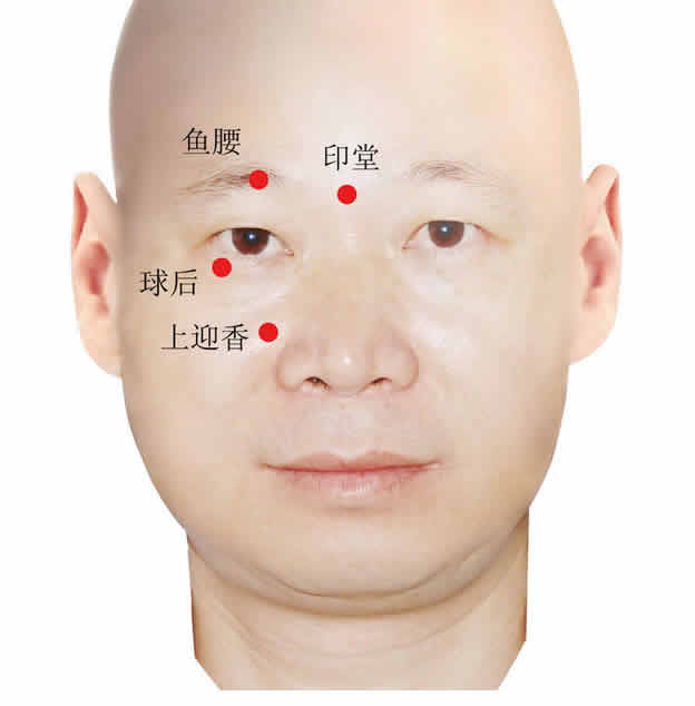 鼻炎艾灸穴位图治疗鼻炎