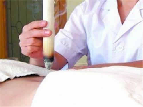艾灸补阳灸背效果强