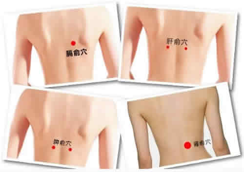 月经三伏灸好吗