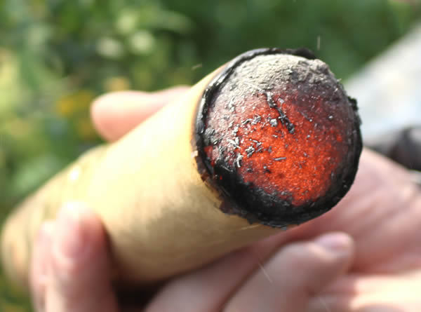 30张艾灸的图片高清大图