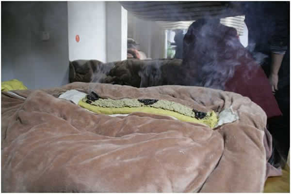 长蛇灸做一次多少钱