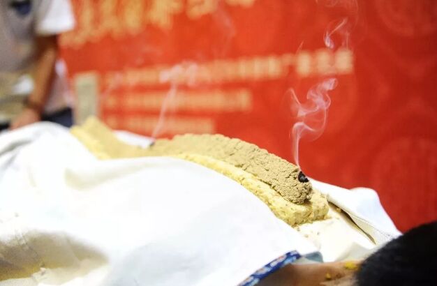 长蛇灸图片高清大图