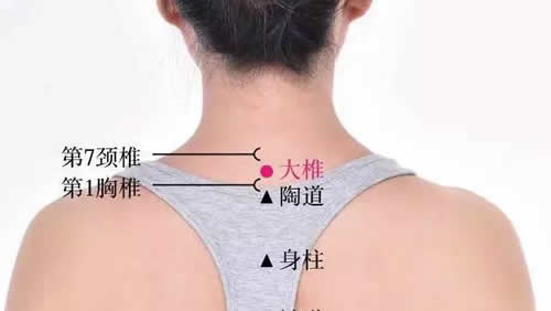 艾灸大椎的好处