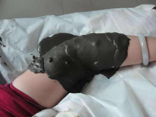 泥灸多久做一次效果好