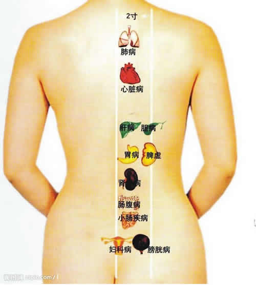 立秋艾灸:大督灸（长蛇灸）疗法