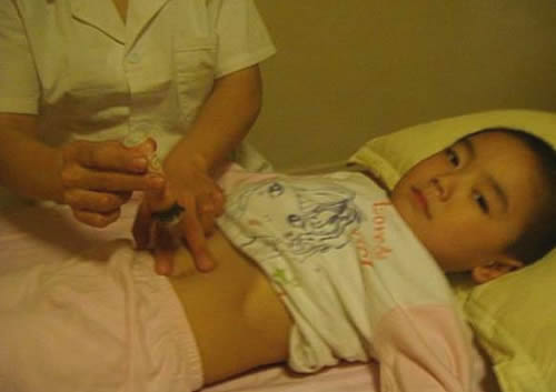 肚子疼艾灸准确位置图