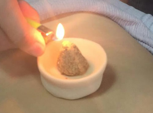 脐灸好处多,三大灸法五注意