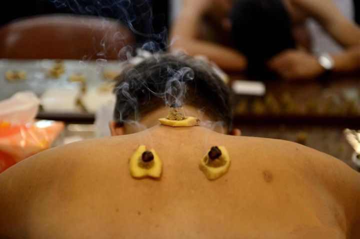 艾灸哪个位置排湿气