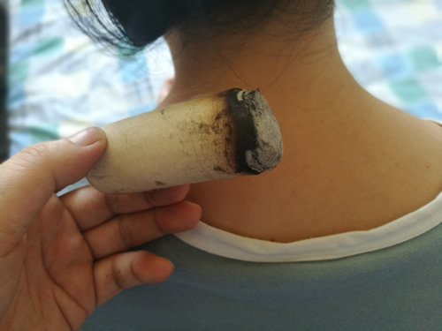艾灸的先后顺序基础内容
