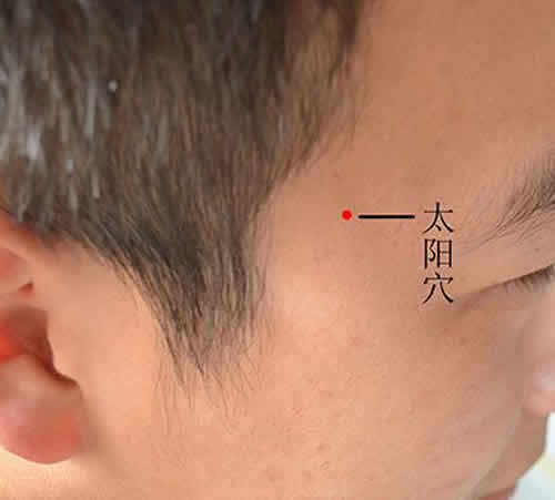 太阳穴疼是怎么回事?太阳穴疼痛原因
