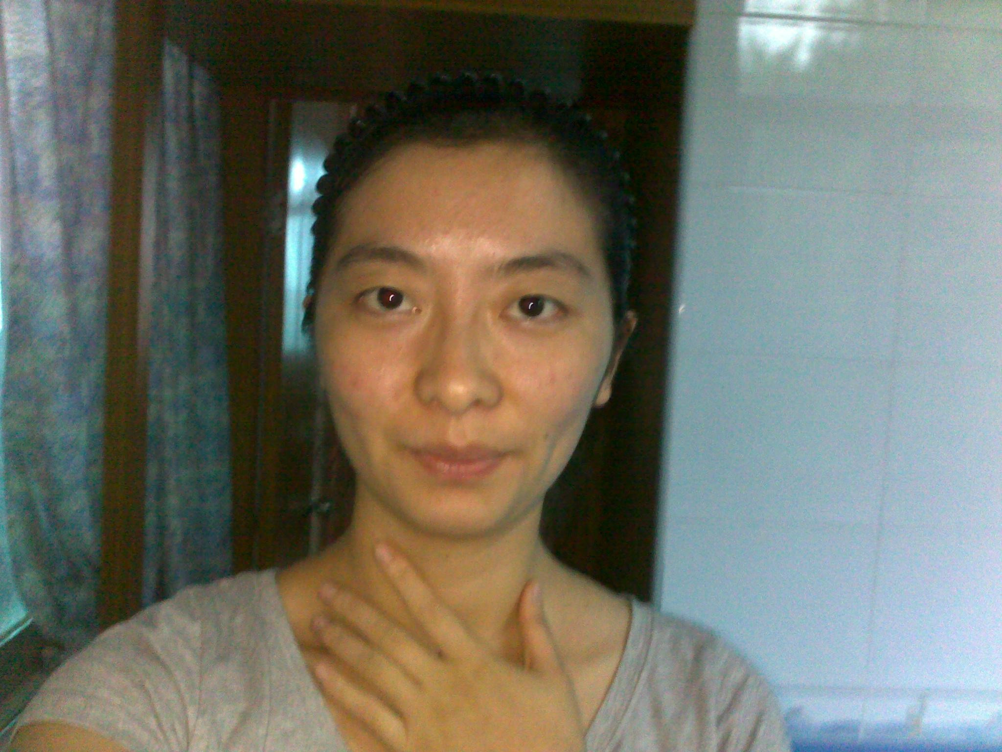 脸色黄面色发黄咋办艾灸调理