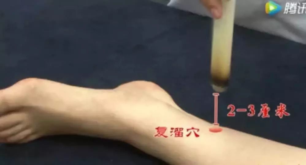 艾灸足三里的功效