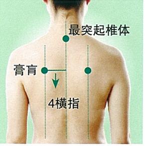 艾灸膏肓穴