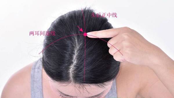 有痔疮怎么办艾灸疗法调理