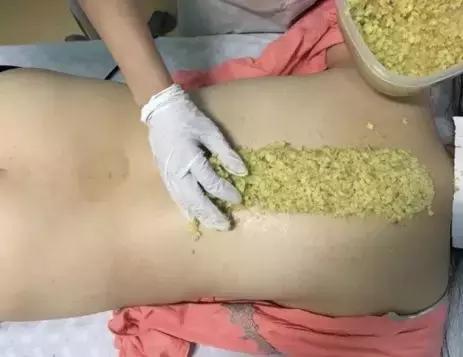 全身冷怎么办?长蛇灸祛寒补阳作用强!