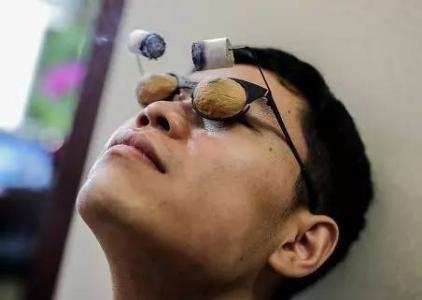 艾灸调理眼睛有什么功效