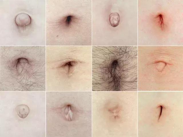 艾炙肚脐后的排湿反应,艾灸肚脐眼作用大!