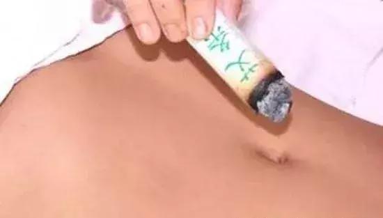 艾炙肚脐后的排湿反应