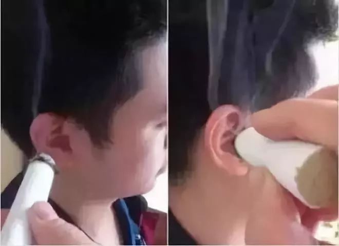 艾灸治疗耳鸣_耳鸣艾灸哪里最有效