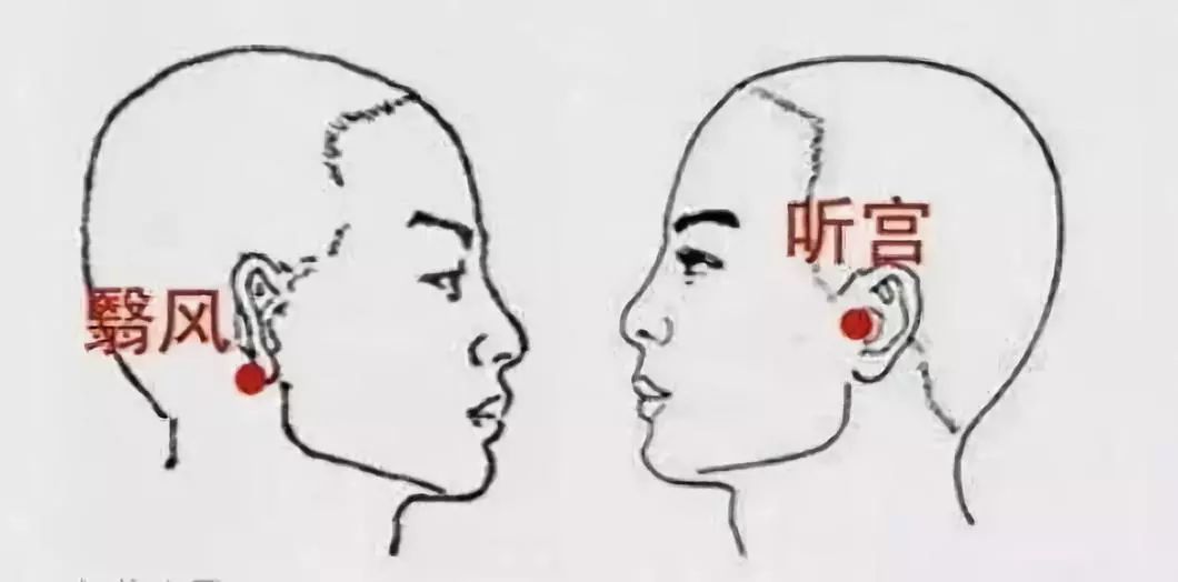 艾灸治疗耳鸣_耳鸣艾灸哪里最有效