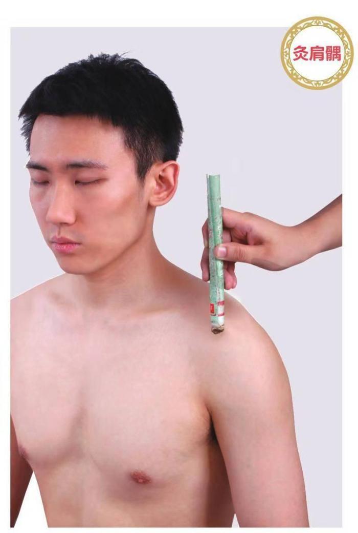 落枕怎么办?落枕肩周疼艾灸来化解！