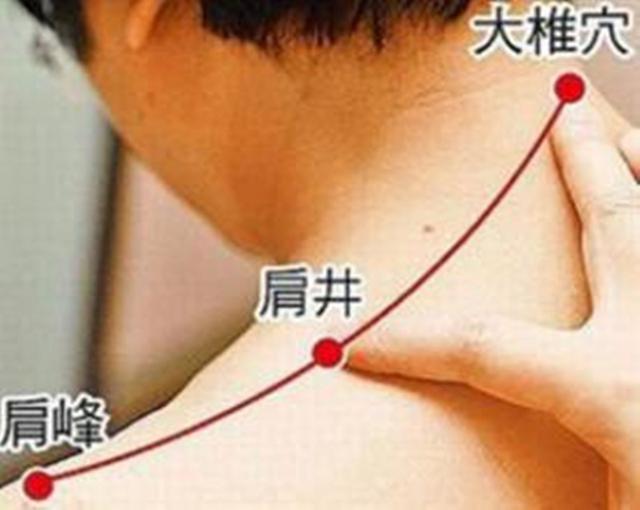 肩颈按摩艾灸哪些穴位?颈肩痛艾灸作用好吗?