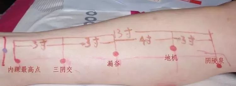 痛风艾灸哪里最好