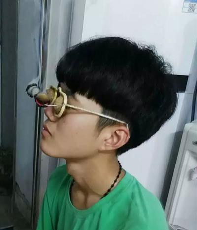 核桃灸:隔核桃眼镜灸操作方法