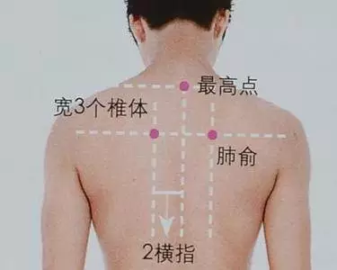 小孩鼻炎艾灸哪个部位