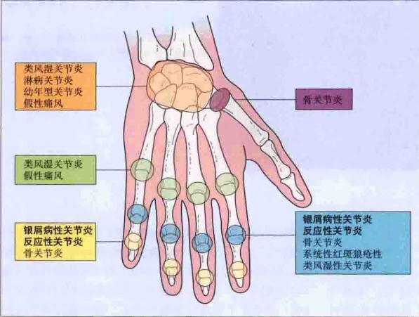 第三章常见病灸疗法与配穴:运动系统疾病