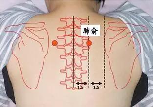 预防新冠肺炎,巧用艾灸增强机体免疫力
