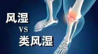 艾灸治疗类风湿