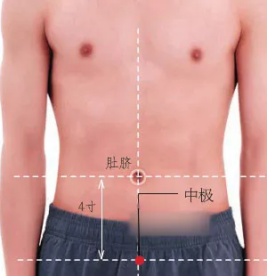 遗精如何治?艾柱灸中极曲骨!