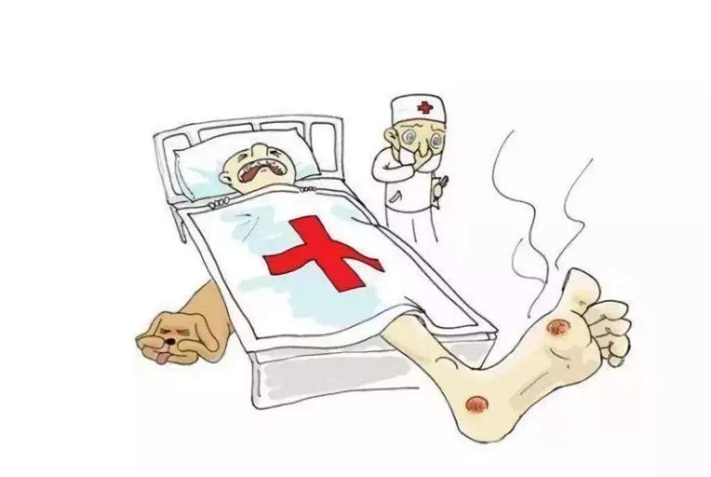 糖尿病足