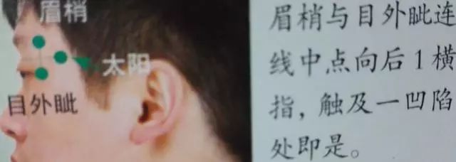 36个艾灸穴位绝穴,个个都实用!