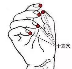 无端手指麻可能脑中风,艾灸三个穴位能杜绝!