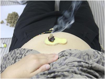 艾灸减肥方法图解