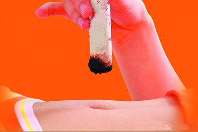 艾灸是最天然、最健康的“止痛药”