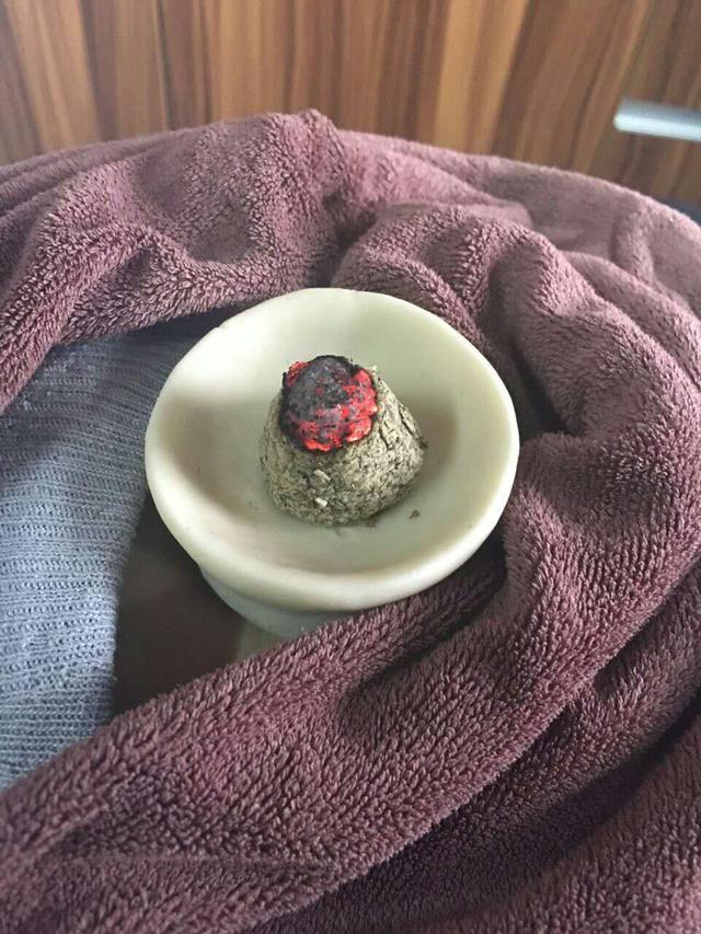 艾灸的禁忌:艾灸后3个小时能洗澡吗?