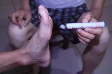 史上较全艾灸方法图解示范