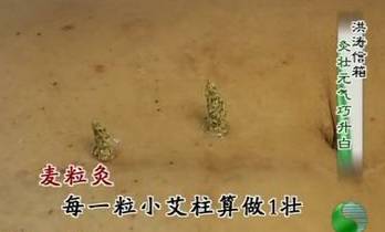 史上较全艾灸方法图解示范