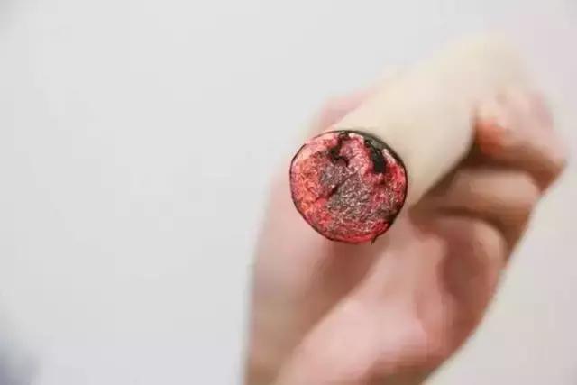 艾灸的好处:春天为什么适合艾灸?