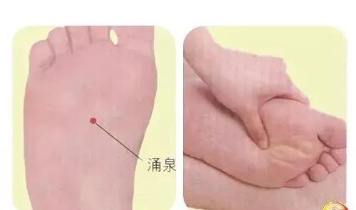 艾灸+刺络放血—双管齐下治湿疹图