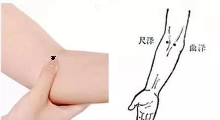 艾灸+刺络放血—双管齐下治湿疹图